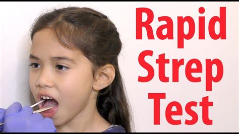 The U. . Cvs rapid strep test